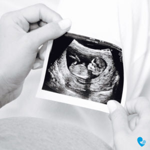 ultrasound-picture